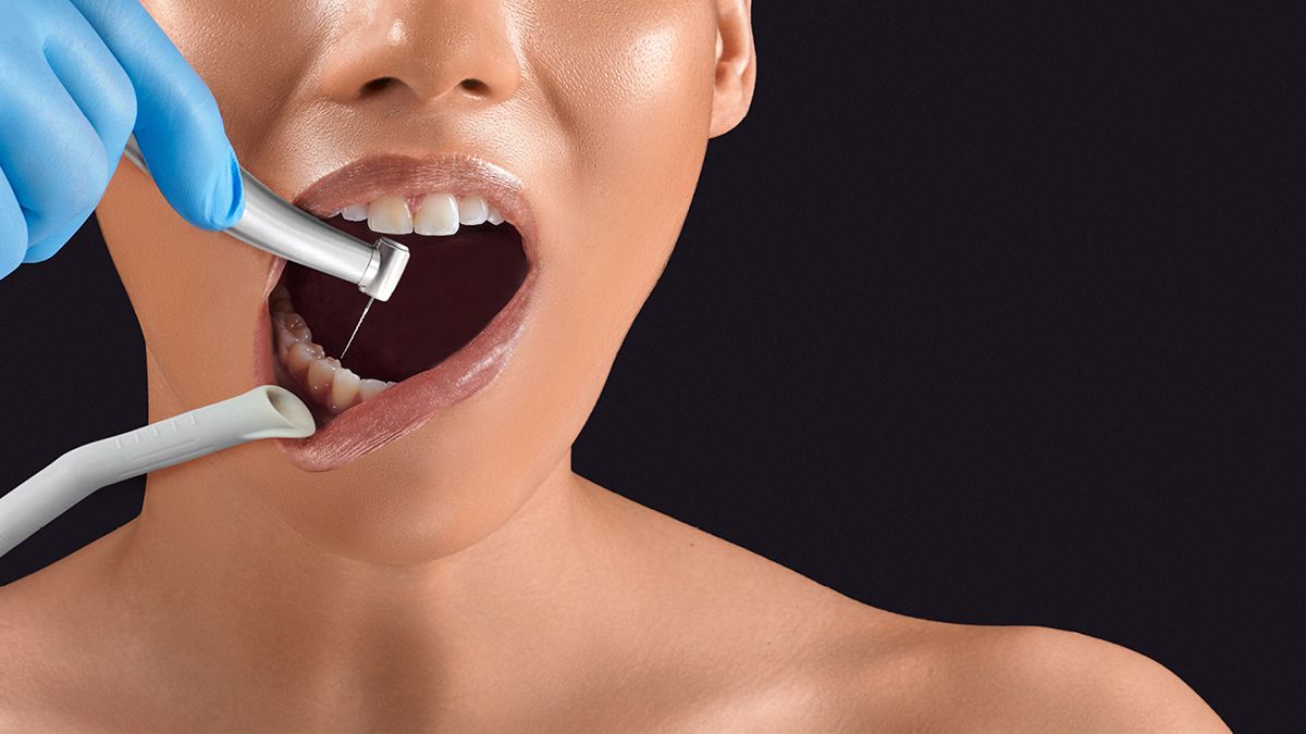 Endodontie in der Zahnarztpraxis